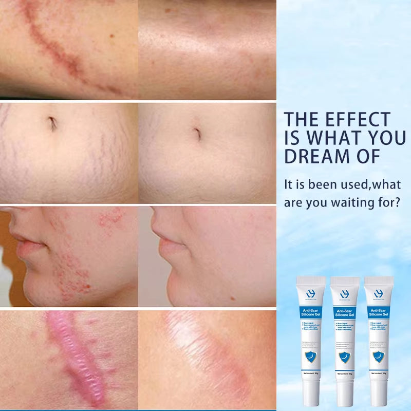 Body Skin Care Cream